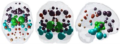 Predictive Model of Spread of Progressive Supranuclear Palsy Using Directional Network Diffusion